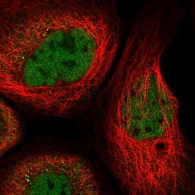 Immunocytochemistry/ Immunofluorescence: RUNX1/CBFA2 Antibody [NBP2-55213]