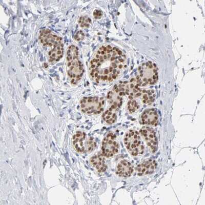 Immunohistochemistry-Paraffin: RUNX1/CBFA2 Antibody [NBP1-89105]