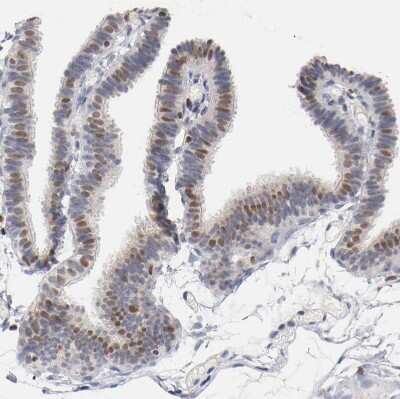 Immunohistochemistry-Paraffin: RUNX1/CBFA2 Antibody [NBP1-89105]