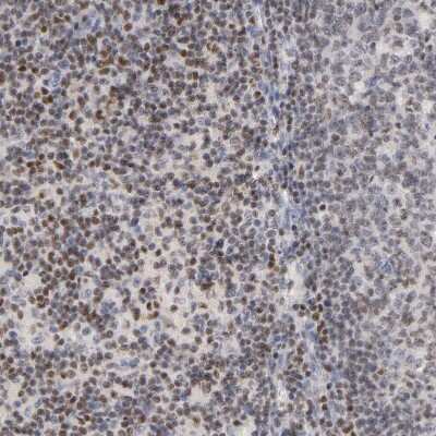 Immunohistochemistry-Paraffin: RUNX1/CBFA2 Antibody [NBP1-89105]