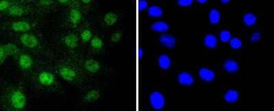 Immunocytochemistry/ Immunofluorescence: RUNX1/CBFA2 Antibody (SD0803) [NBP2-67779]