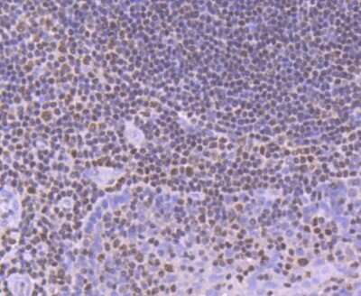Immunohistochemistry-Paraffin: RUNX1/CBFA2 Antibody (SD0803) [NBP2-67779]