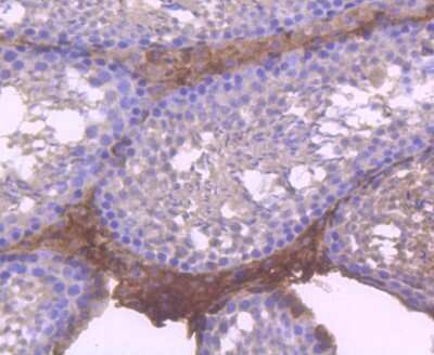 Immunohistochemistry-Paraffin: RUNX1/CBFA2 Antibody (SD0803) [NBP2-67779]