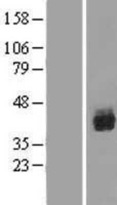 Western Blot: RUNX1/CBFA2 Overexpression Lysate [NBP2-08962]