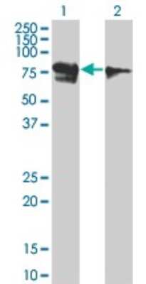 Western Blot: RUNX1T1/ETO Antibody (5A12) [H00000862-M01]