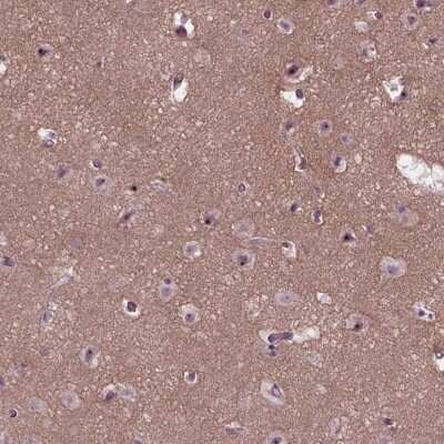 Immunohistochemistry: RUNX1T1/ETO Antibody [NBP2-49644]