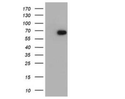 Western Blot: RUNX1T1/ETO Antibody (OTI1H1)Azide and BSA Free [NBP2-73956]