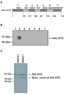 Western Blot: RUNX1T1/ETO Antibody [NBP3-18685]