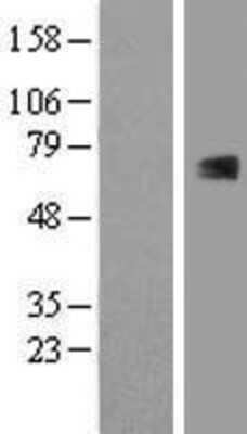 Western Blot: RUNX1T1/ETO Overexpression Lysate [NBL1-15626]