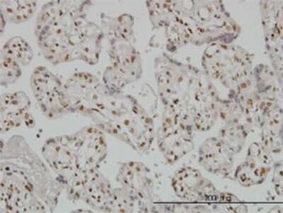 Immunohistochemistry-Paraffin: RUNX2/CBFA1 Antibody (1D8) [H00000860-M01]