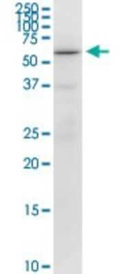 Western Blot: RUNX2/CBFA1 Antibody (1D8) [H00000860-M01]