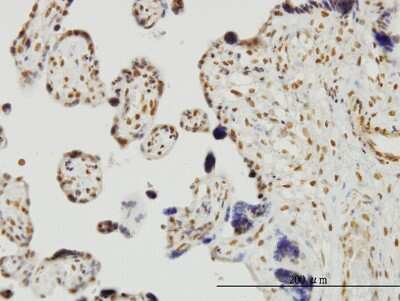 Immunohistochemistry-Paraffin: RUNX2/CBFA1 Antibody (3F5) [H00000860-M06]