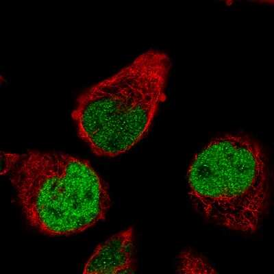 Immunocytochemistry/ Immunofluorescence: RUNX2/CBFA1 Antibody (CL0232) [NBP2-52887]