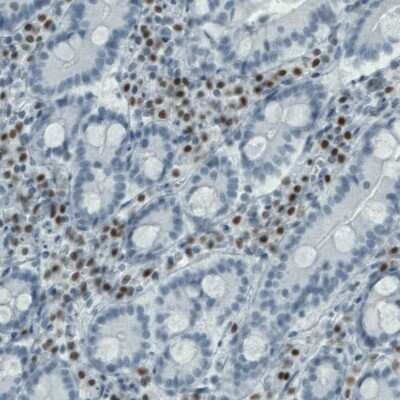 Immunohistochemistry-Paraffin: RUNX2/CBFA1 Antibody (CL0232) [NBP2-52887]