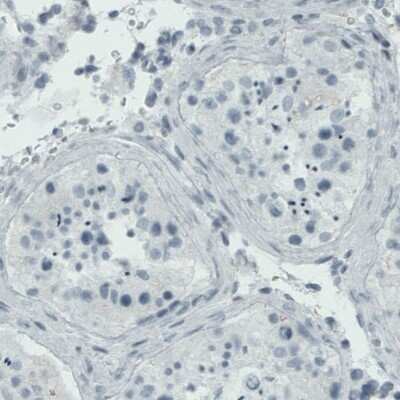 Immunohistochemistry-Paraffin: RUNX2/CBFA1 Antibody (CL0232) [NBP2-52887]