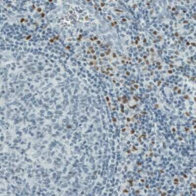 Immunohistochemistry-Paraffin: RUNX2/CBFA1 Antibody (CL0232) [NBP2-52887]