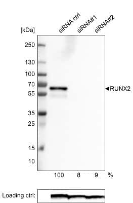 Western Blot: RUNX2/CBFA1 Antibody (CL0232) [NBP2-52887]