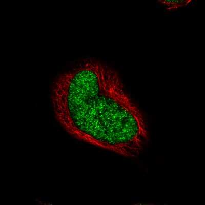 Immunocytochemistry/ Immunofluorescence: RUNX2/CBFA1 Antibody (CL0235) [NBP2-52888]