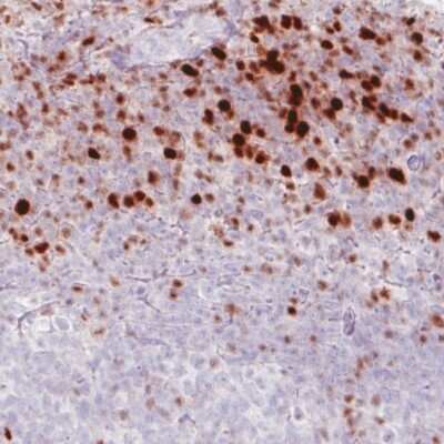 Immunohistochemistry-Paraffin: RUNX2/CBFA1 Antibody (CL0235) [NBP2-52888]