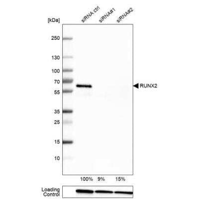 Western Blot: RUNX2/CBFA1 Antibody (CL0235) [NBP2-52888]