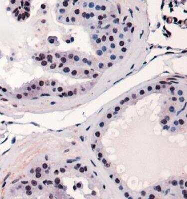 Immunohistochemistry: RUNX2/CBFA1 Antibody - BSA Free [NBP1-77461]