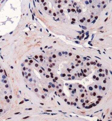 Immunohistochemistry: RUNX2/CBFA1 Antibody - BSA Free [NBP1-77462]