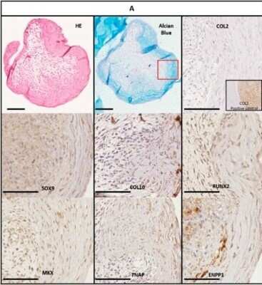 Immunohistochemistry-Paraffin: RUNX2/CBFA1 Antibody - BSA Free [NBP1-77461]