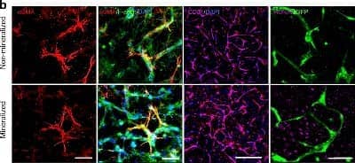 Immunohistochemistry-Paraffin: RUNX2/CBFA1 Antibody - BSA Free [NBP1-77461]