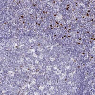 Immunohistochemistry-Paraffin: RUNX2/CBFA1 Antibody [NBP1-89104]