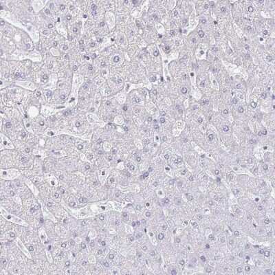 Immunohistochemistry-Paraffin: RUNX2/CBFA1 Antibody [NBP1-89104]