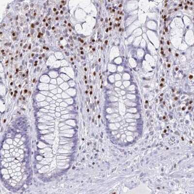 Immunohistochemistry-Paraffin: RUNX2/CBFA1 Antibody [NBP1-89104]