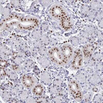 Immunohistochemistry-Paraffin: RUNX2/CBFA1 Antibody [NBP1-89104]