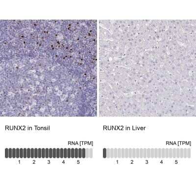 Immunohistochemistry-Paraffin: RUNX2/CBFA1 Antibody [NBP1-89104]