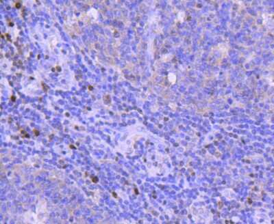 Immunohistochemistry-Paraffin: RUNX2/CBFA1 Antibody (SD208-0) [NBP2-67777]