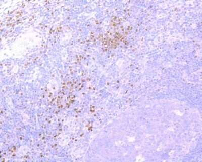 Immunohistochemistry-Paraffin: RUNX2/CBFA1 Antibody (SD208-0) [NBP2-67777]