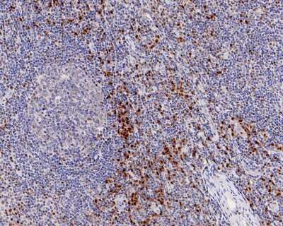 Immunohistochemistry-Paraffin: RUNX2/CBFA1 Antibody (SD208-0) [NBP2-67777]