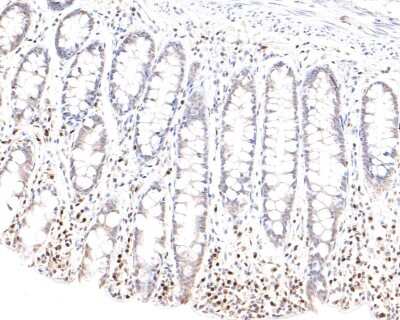 Immunohistochemistry-Paraffin: RUNX2/CBFA1 Antibody (SD208-0) [NBP2-67777]