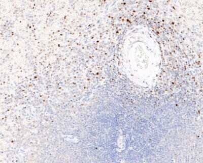 Immunohistochemistry-Paraffin: RUNX2/CBFA1 Antibody (SD208-0) [NBP2-67777]