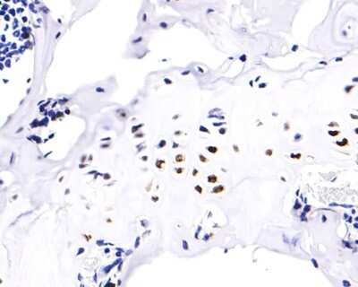 Immunohistochemistry-Paraffin: RUNX2/CBFA1 Antibody (SD208-0) [NBP2-67777]