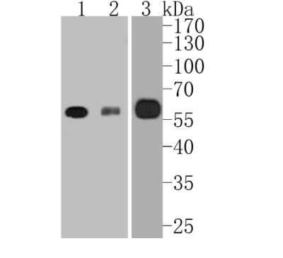 Western Blot: RUNX2/CBFA1 Antibody (SD208-0) [NBP2-67777]