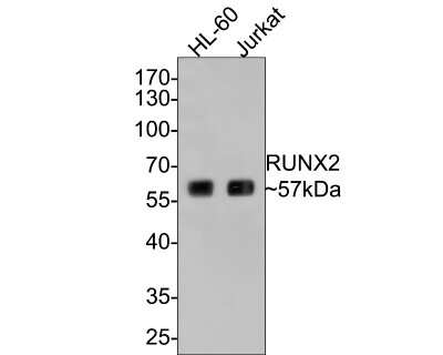 Western Blot: RUNX2/CBFA1 Antibody (SD208-0) [NBP2-67777]