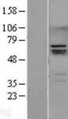 Western Blot: RUNX2/CBFA1 Overexpression Lysate [NBL1-15627]