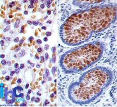 Immunocytochemistry: RUNX3/CBFA3 Antibody (2B9G4) - Azide and BSA Free [NBP2-80933]