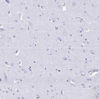 Immunohistochemistry-Paraffin: RUNX3/CBFA3 Antibody [NBP2-38863]