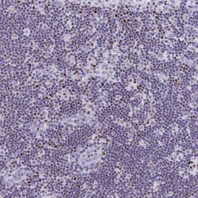 Immunohistochemistry-Paraffin: RUNX3/CBFA3 Antibody [NBP2-38863]
