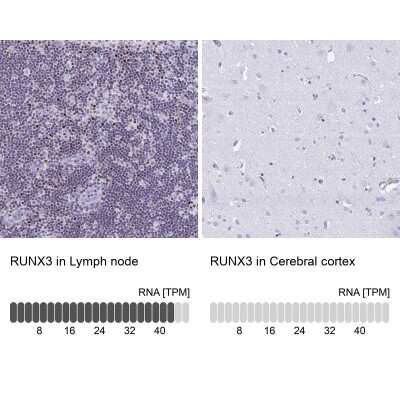 Immunohistochemistry-Paraffin: RUNX3/CBFA3 Antibody [NBP2-38863]
