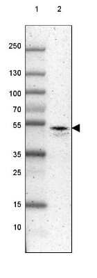 Western Blot: RUNX3/CBFA3 Antibody [NBP2-38863]