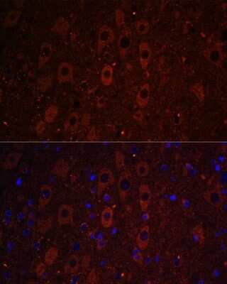 Immunohistochemistry: RUSC1 Antibody - Azide and BSA Free [NBP2-93950]