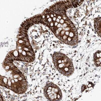 Immunohistochemistry-Paraffin: RUSC1 Antibody [NBP1-81006]