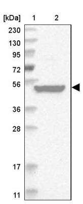 Western Blot: RUSC1 Antibody [NBP1-81004]